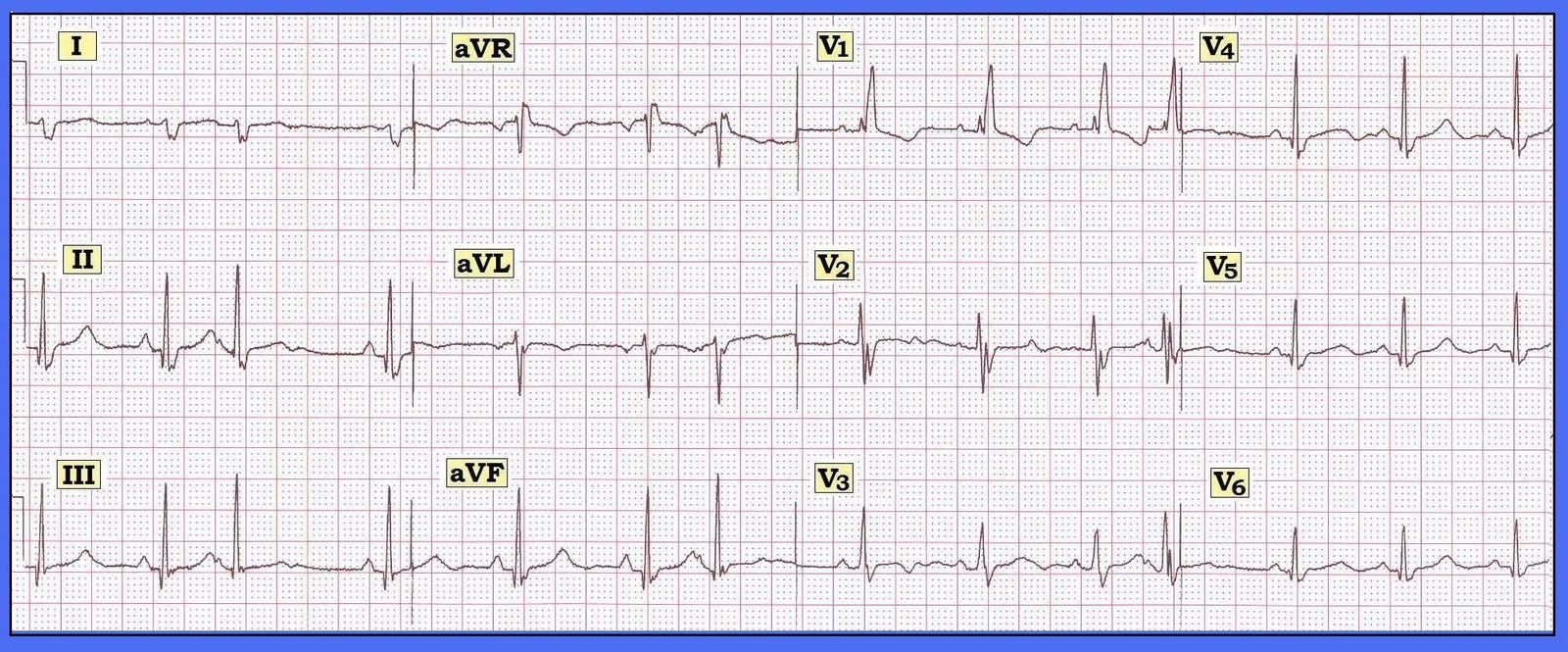 Ecg rhythm strip examples figure 29 Nice pussy anal